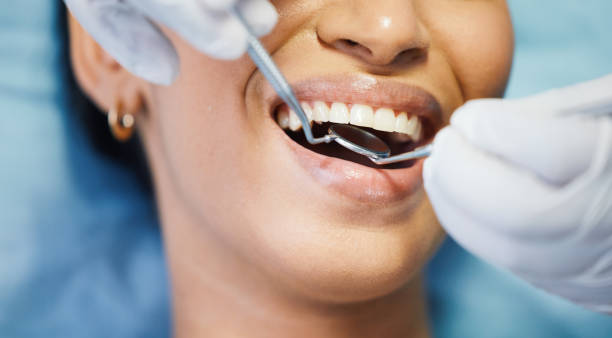 Laser Dentistry in Bowling Green, FL